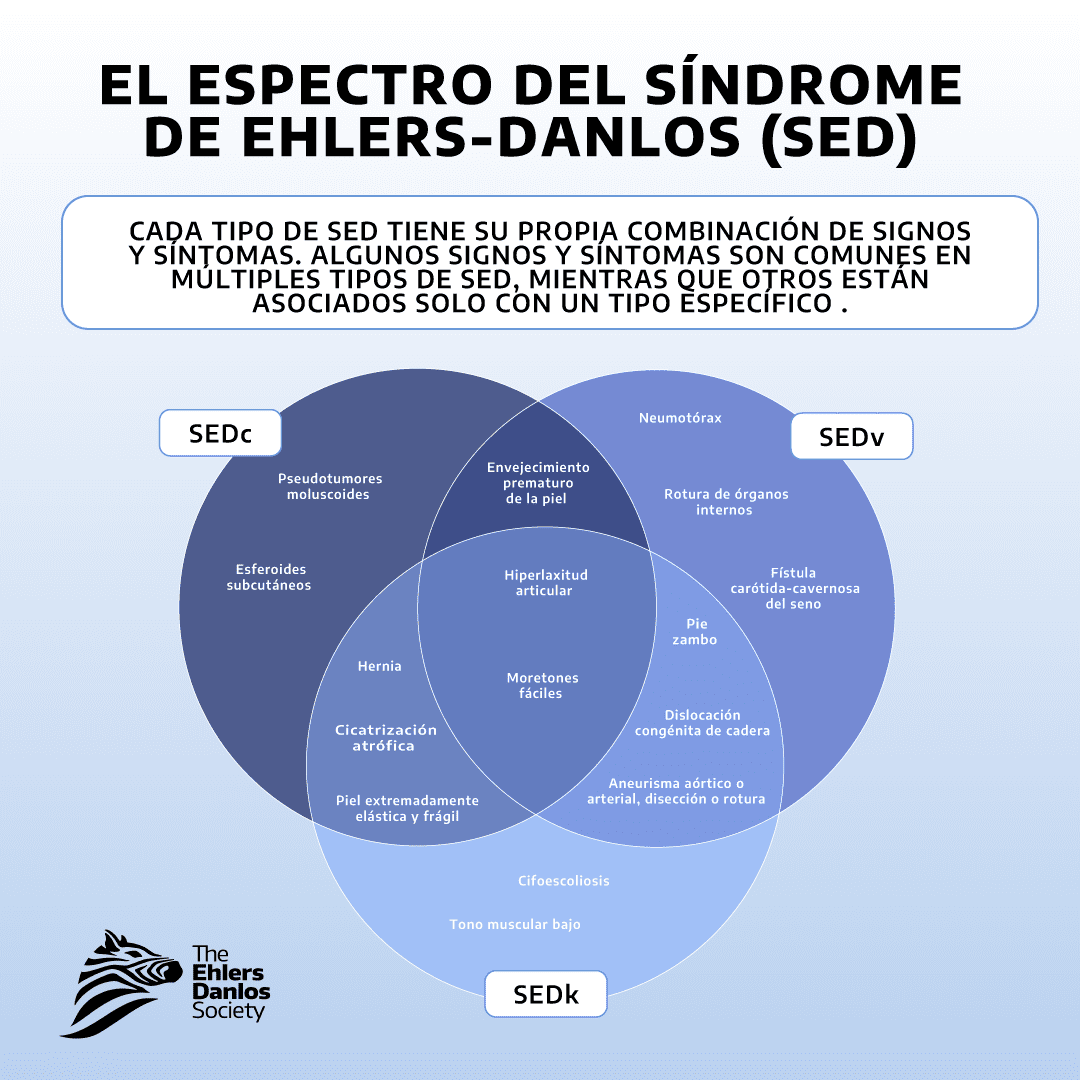 ig_eds_spectrum_graphic_updated